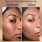 Neck Firming & Tightening Cream – Anti-Aging Lifting Moisturizer for Neck, Face & Décolleté